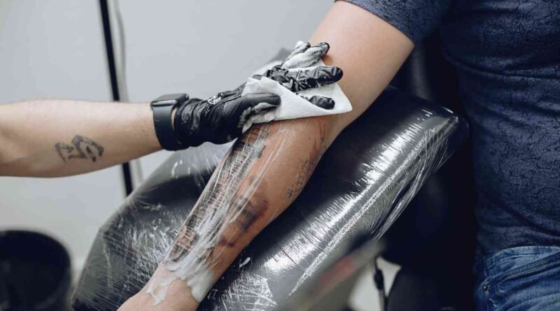 10 Best Tattoo Removal Technology in 2024 