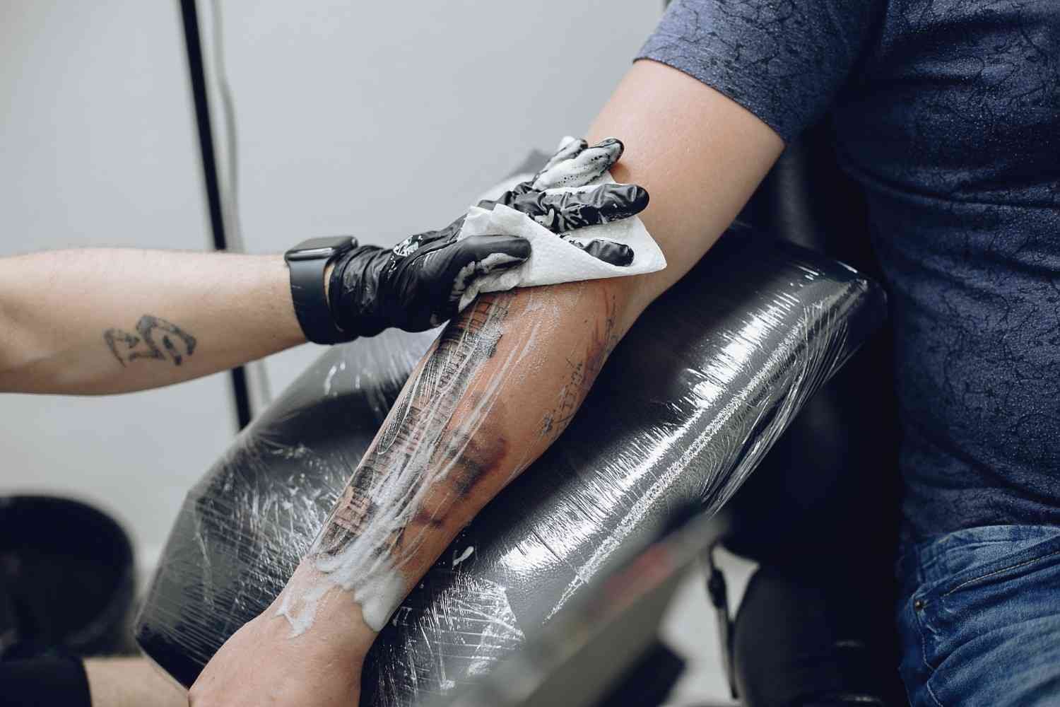 10 Best Tattoo Removal Technology in 2024 