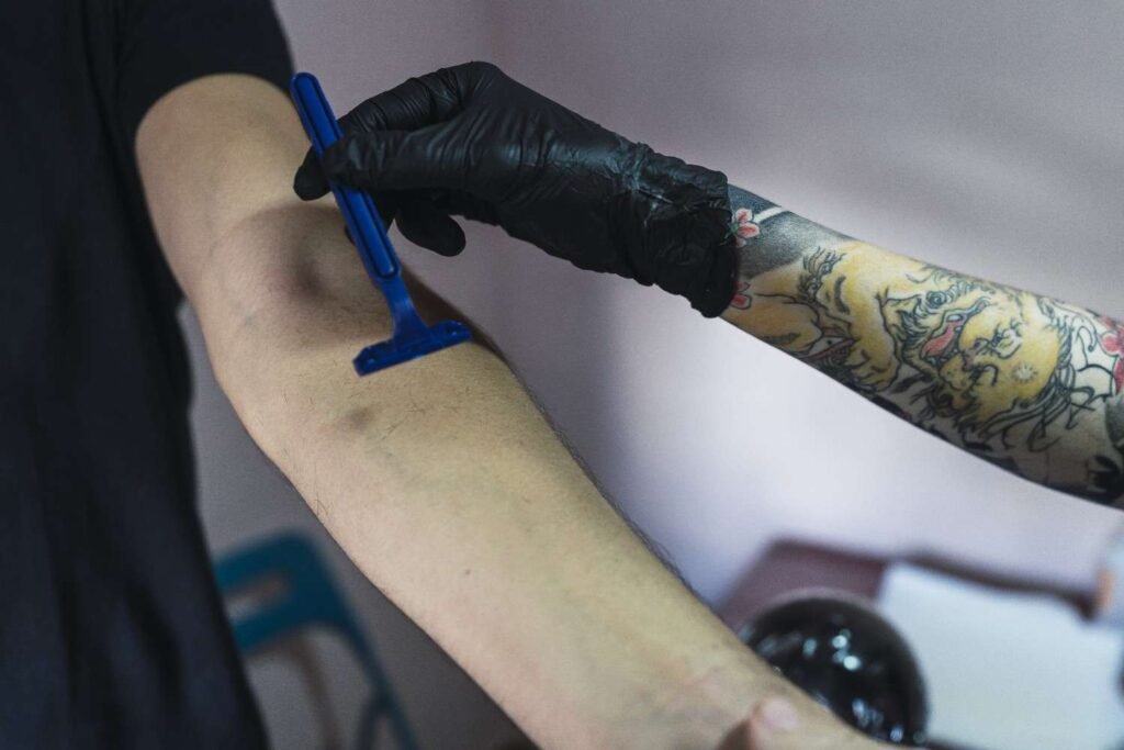 10 Best Tattoo Removal Technology in 2024 